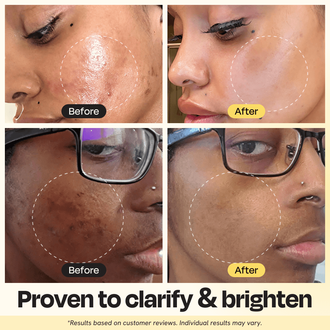 Vitamin C Clay Mask Gleamin