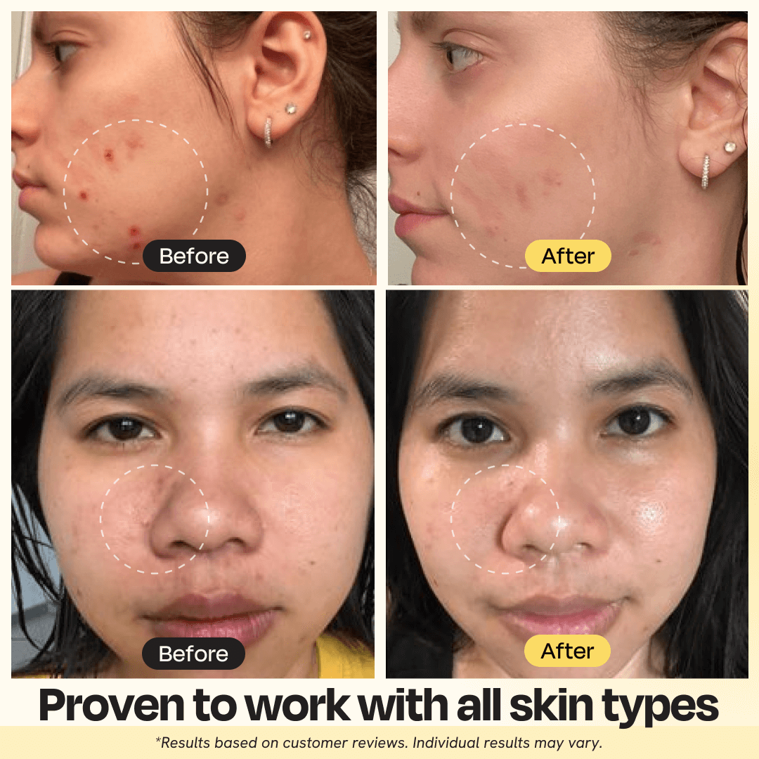Vitamin C Clay Mask Gleamin
